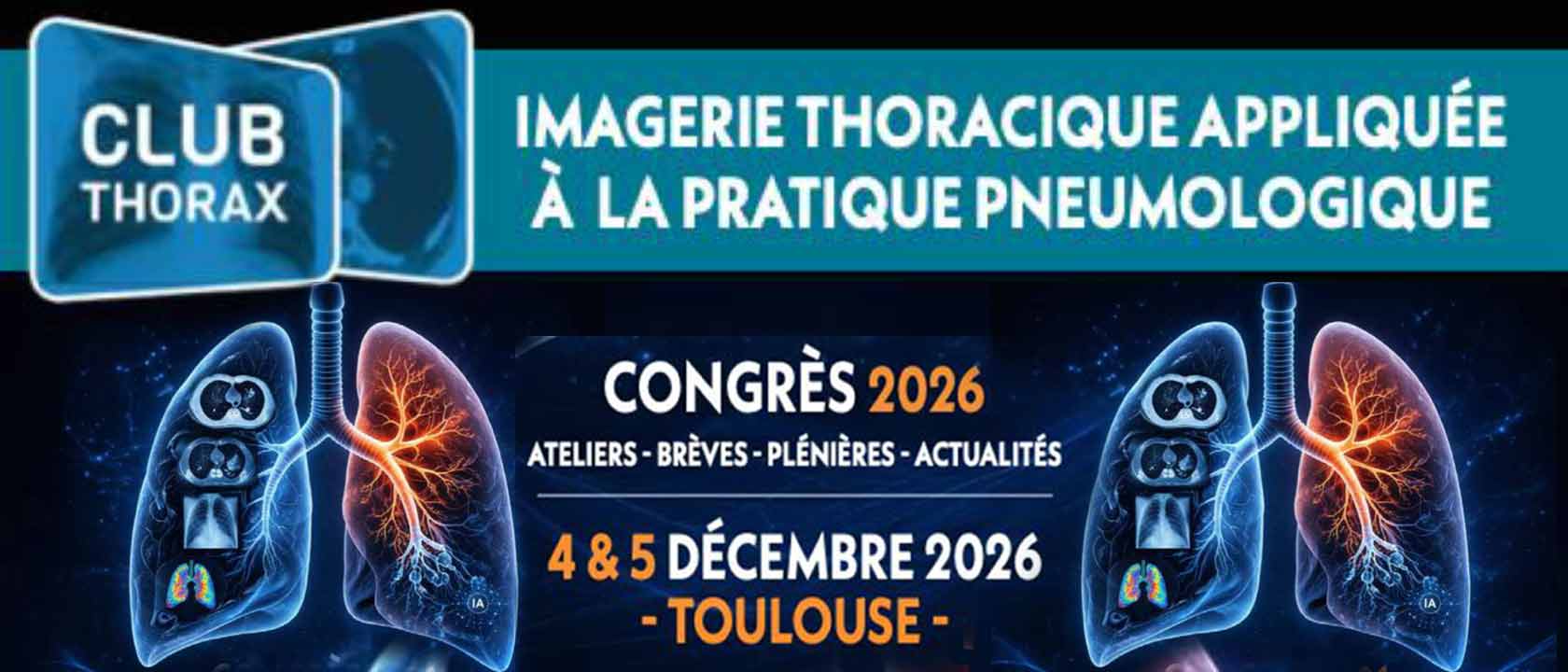 Imagerie Thoracique Appliquée à la Pratique Pneumologique